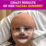 ST, Dylan Mulvaney, Transgender and Activist, Reveals Crazy Results of Her Facial Surgery